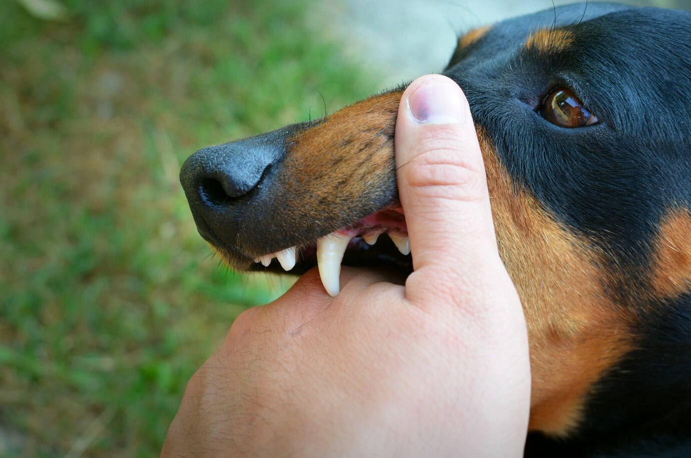 Vicious Dog Showing Teeth Biting Hand 342744 788
